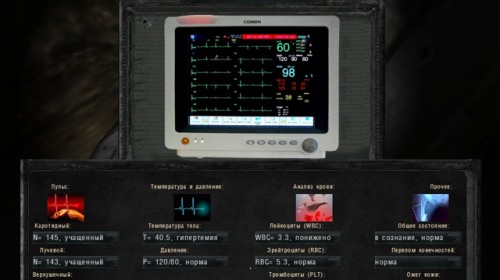 S.T.A.L.K.E.R.: Смерти вопреки
